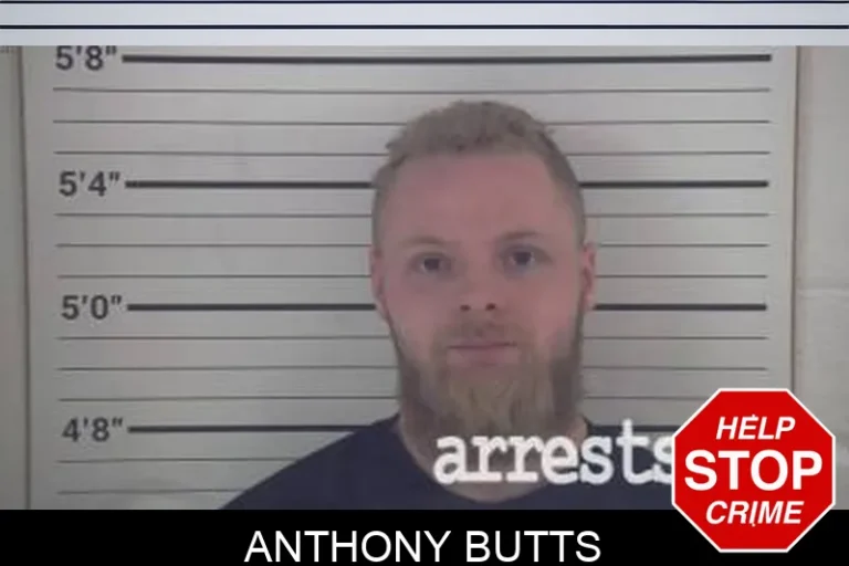 Anthony BuTts