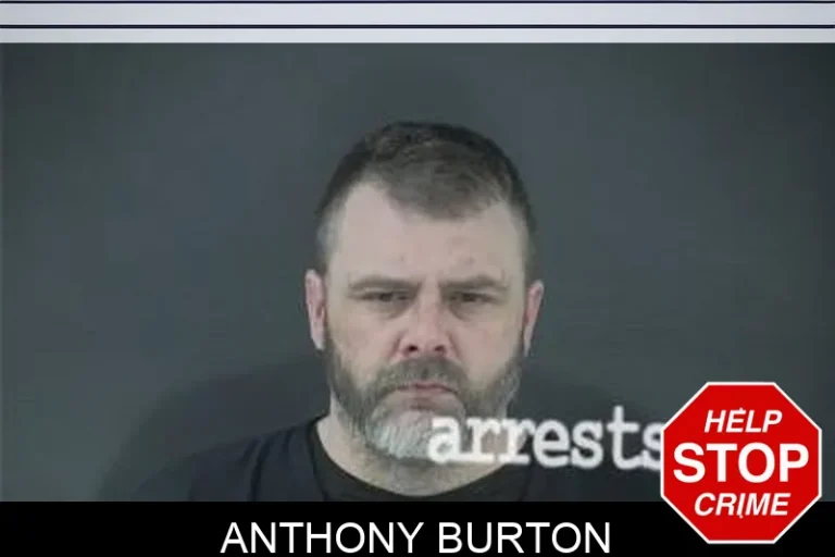 Anthony Burton