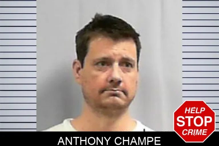 Anthony Champe
