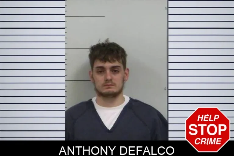 Anthony Defalco