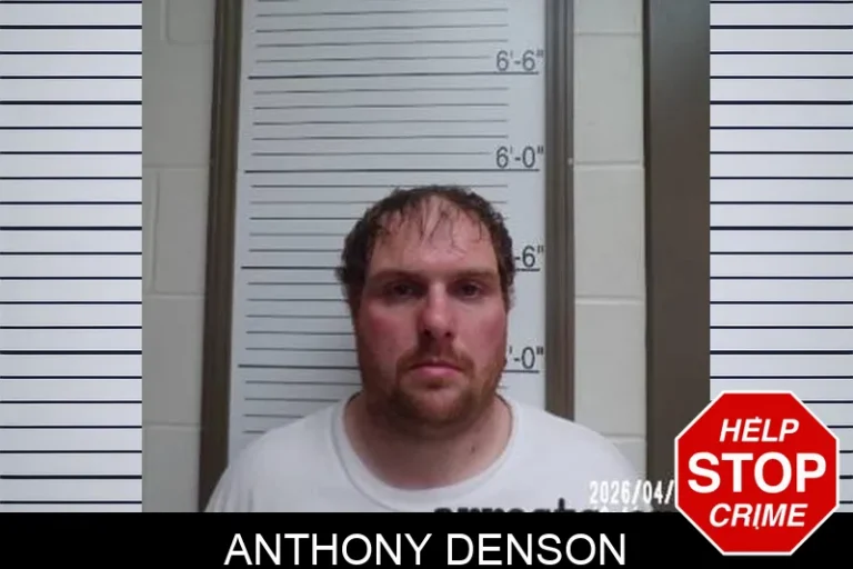 Anthony Denson