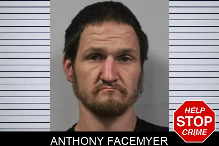 Anthony Facemyer