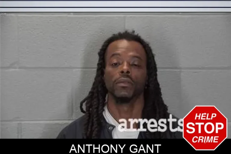 Anthony Gant