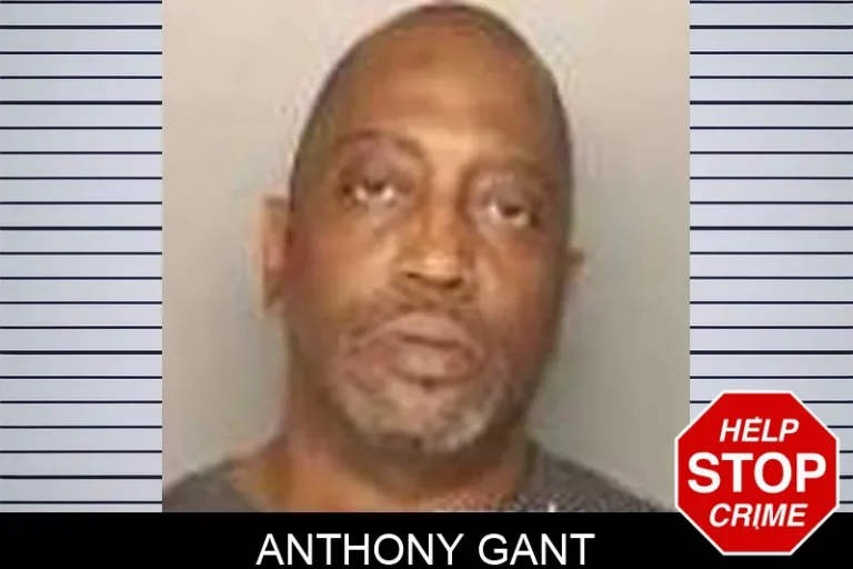 Anthony Gant