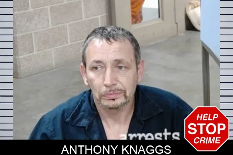 Anthony Knaggs