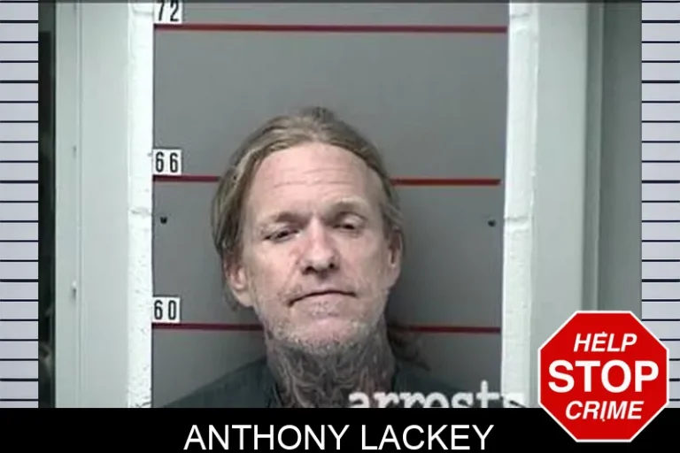 Anthony Lackey