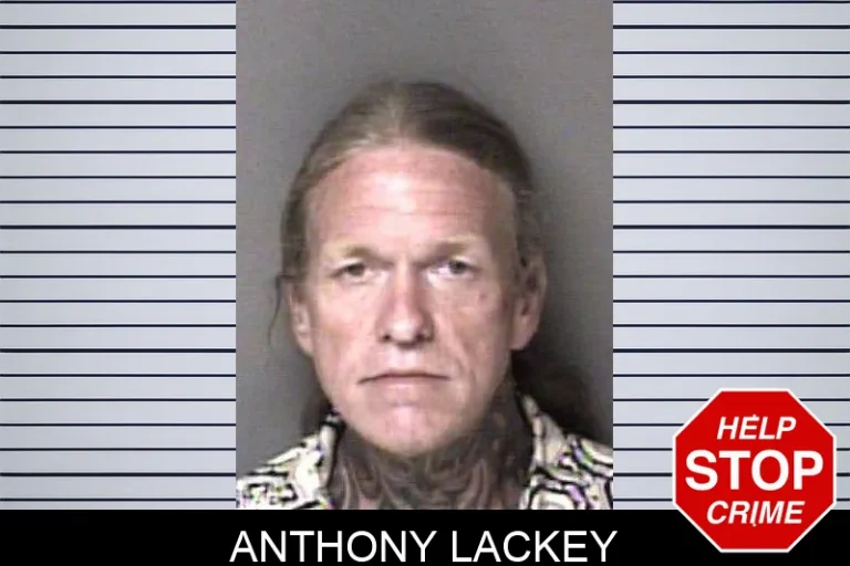 Anthony Lackey
