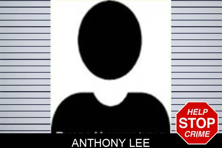 Anthony Lee
