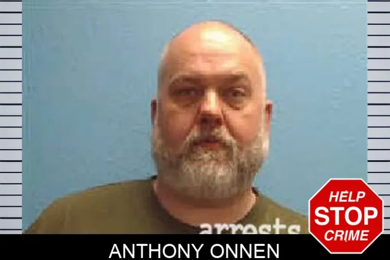 Anthony Onnen