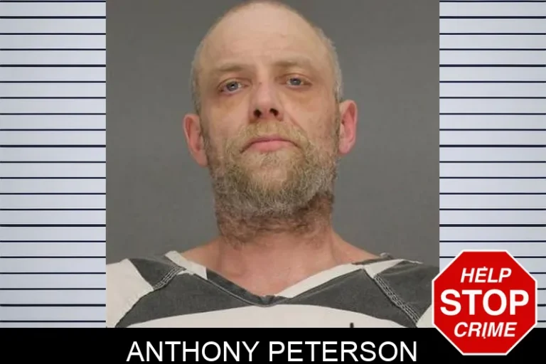Anthony Peterson