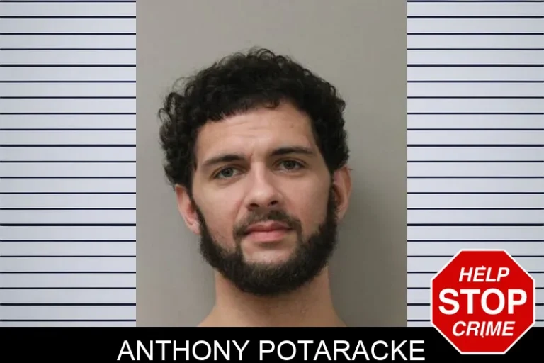 Anthony Potaracke