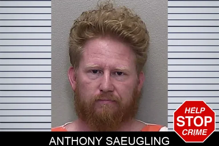 Anthony SaeuGling