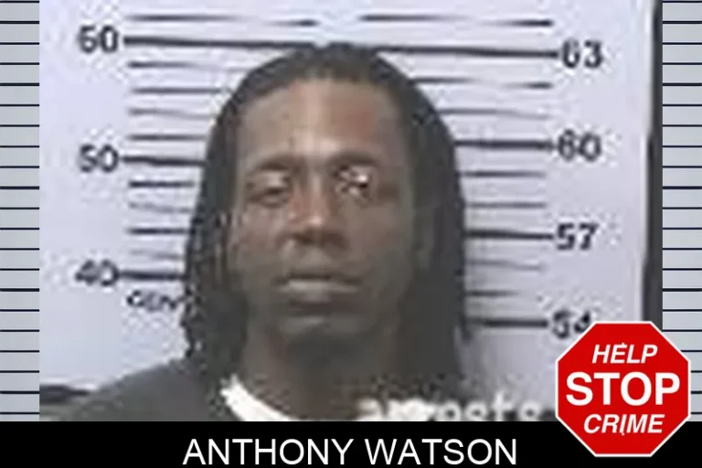 Anthony Watson