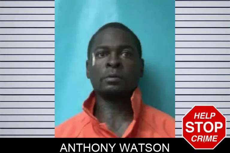 Anthony Watson