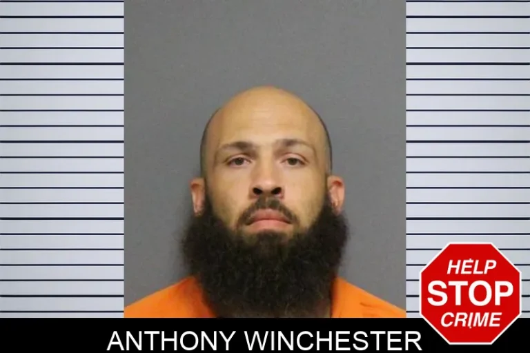 Anthony Winchester