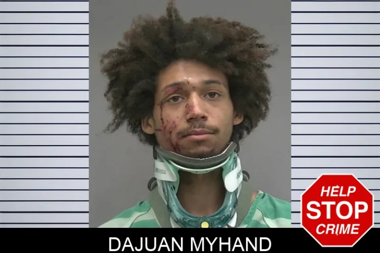 DajuAn Myhand
