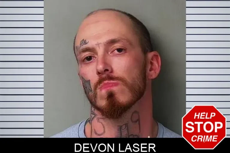 Devon Laser