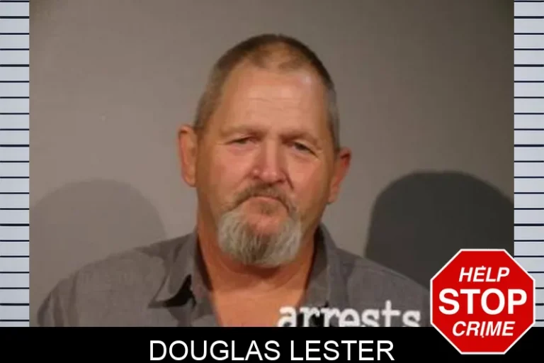 DouGlas Lester