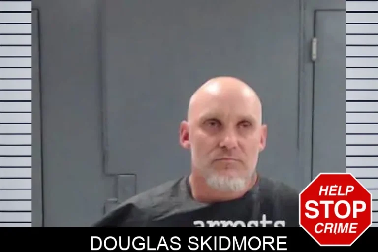DouGlas Skidmore