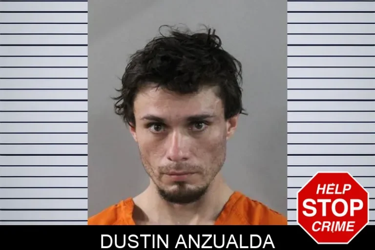 DuStin AnzuAlda