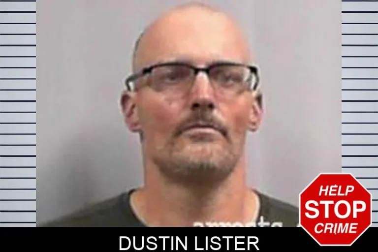 DuStin Lister