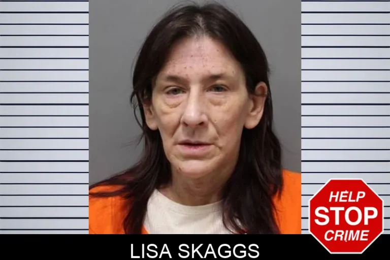 Lisa Skaggs