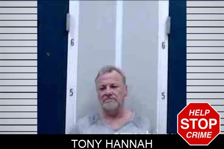Tony Hannah