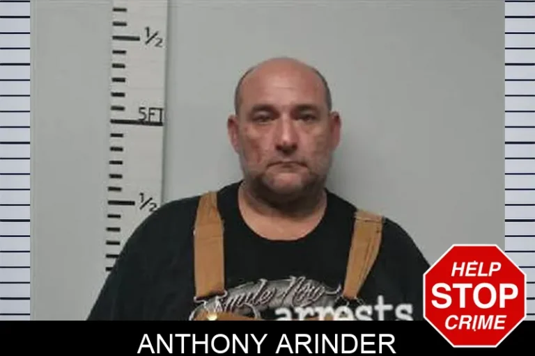Anthony Arinder