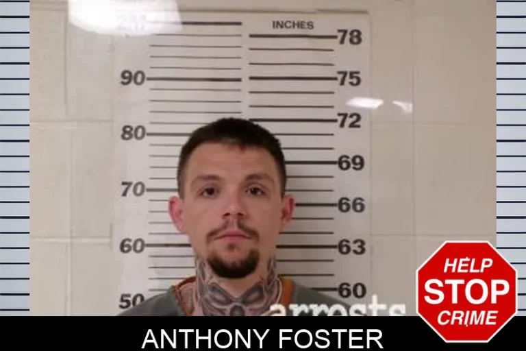 Anthony Foster