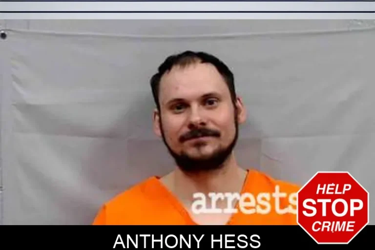 Anthony Hess