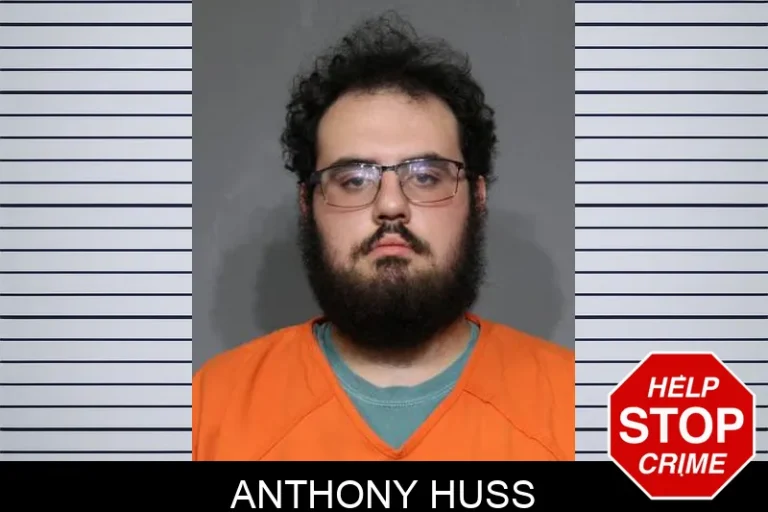 Anthony Huss