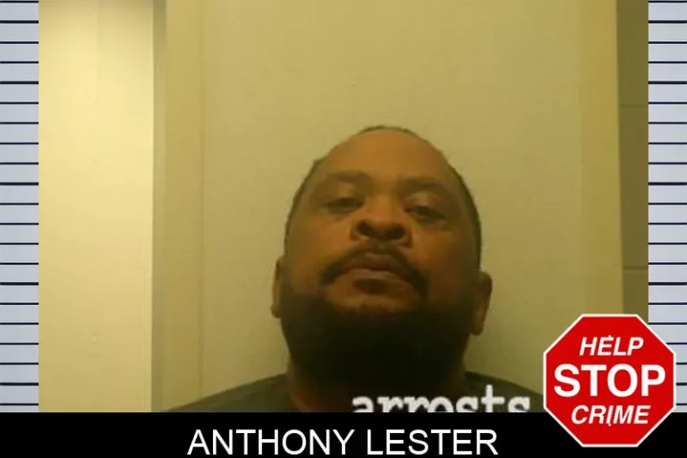 Anthony Lester