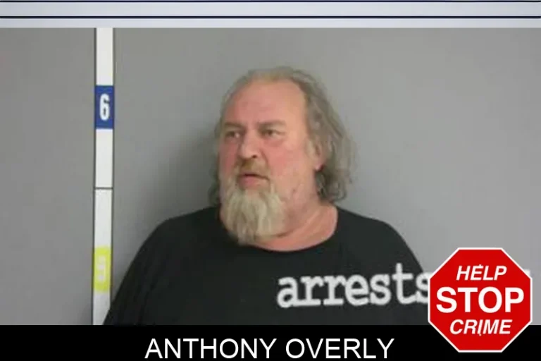 Anthony Overly