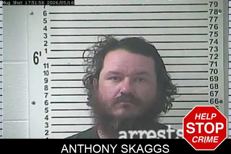 Anthony Skaggs
