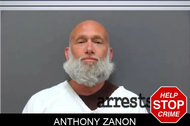 Anthony Zanon