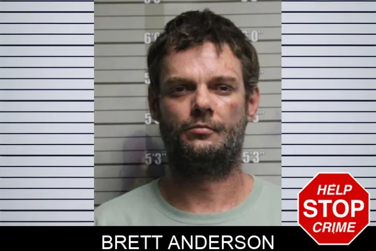 Brett Anderson