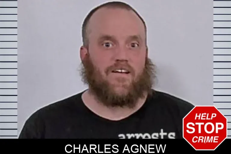 Charles Agnew