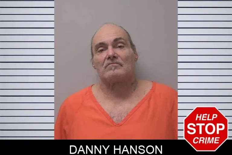 Danny Hanson