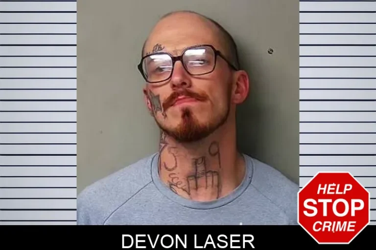 Devon Laser