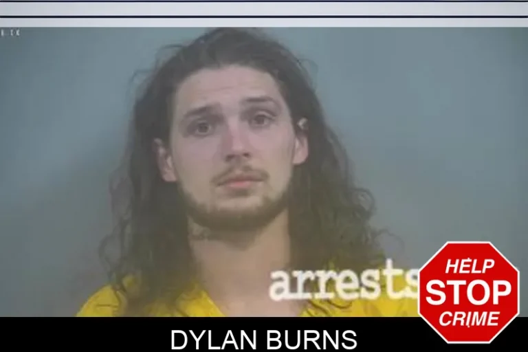 Dylan Burns