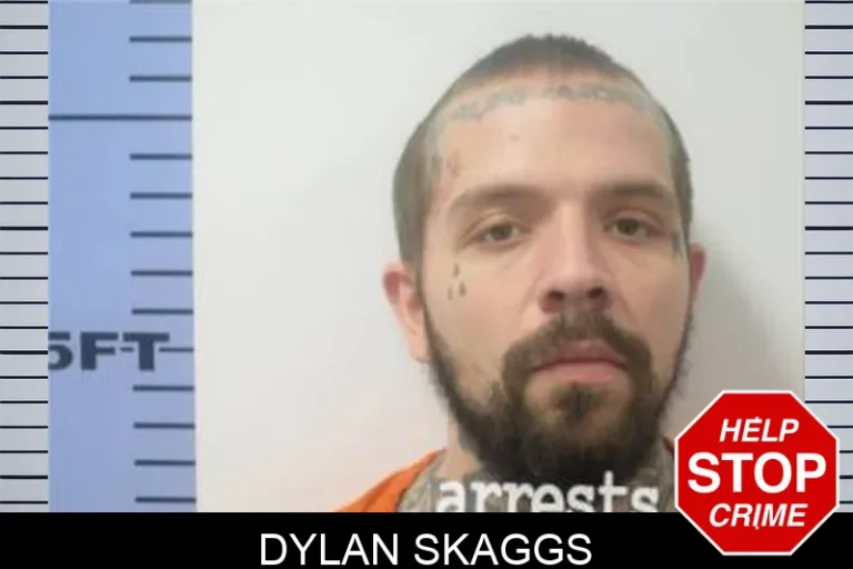 Dylan Skaggs