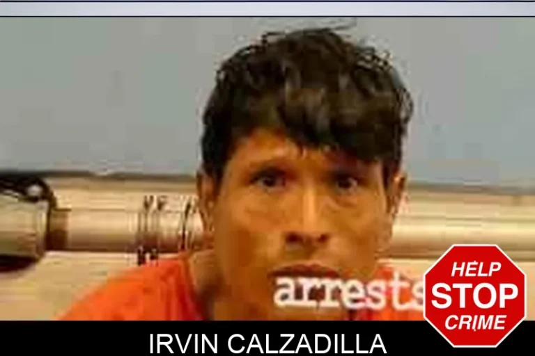 Irvin Calzadilla
