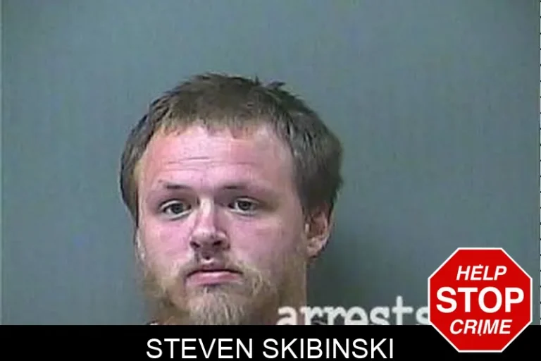 Steven Skibinski