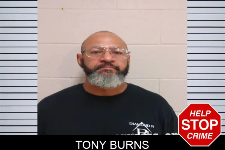 Tony Burns