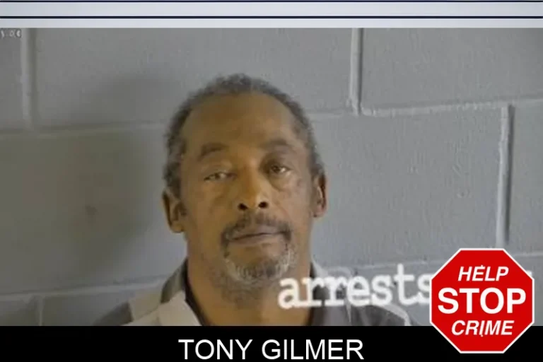 Tony Gilmer
