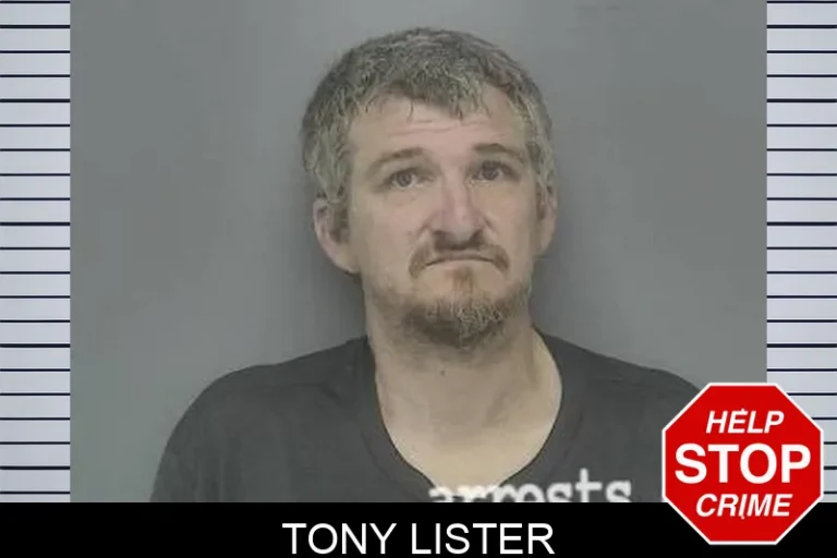 Tony Lister