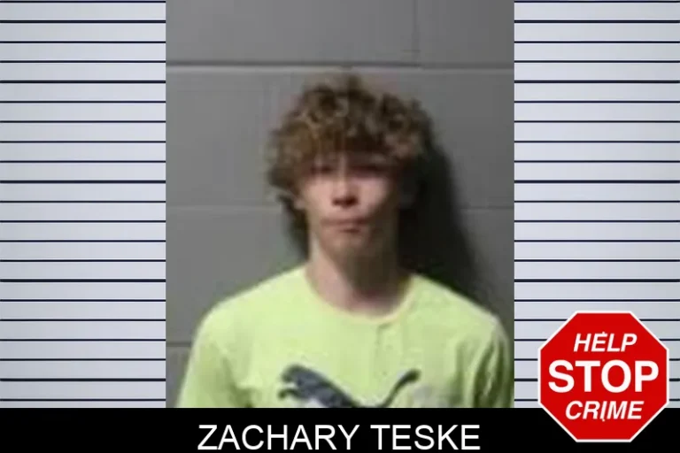 Zachary Teske