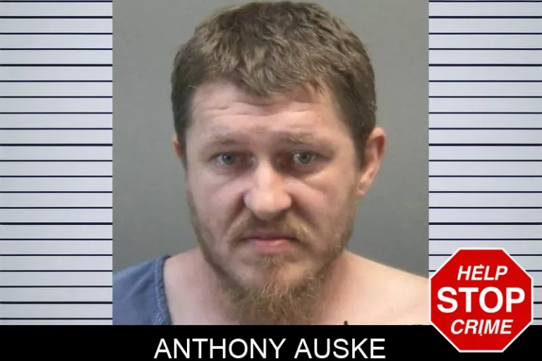 Anthony Auske
