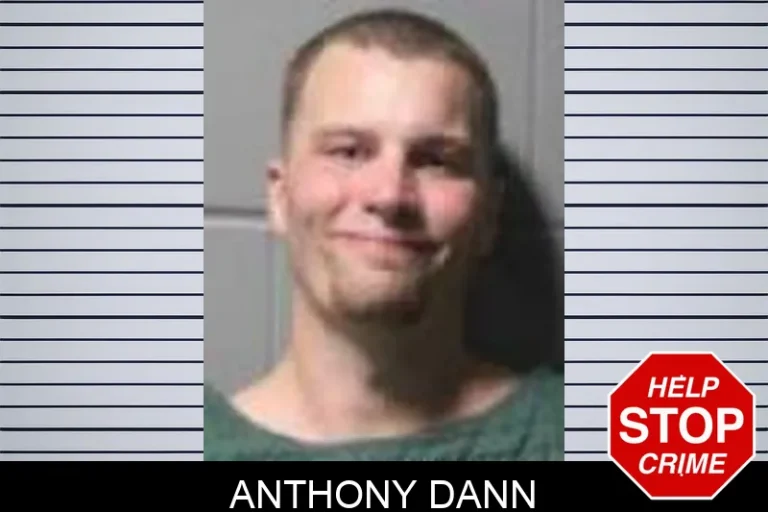 Anthony Dann