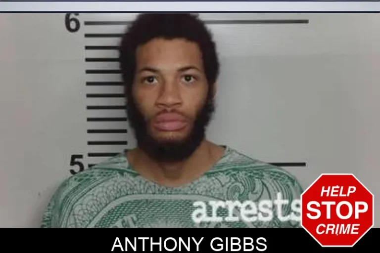 Anthony Gibbs